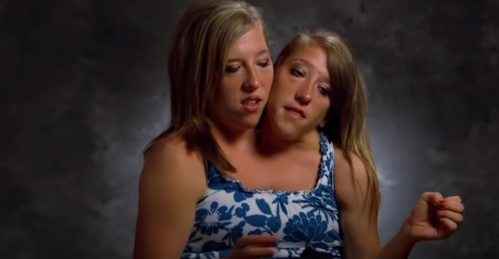 10种怪异的两个头动物,10种变异双头动物