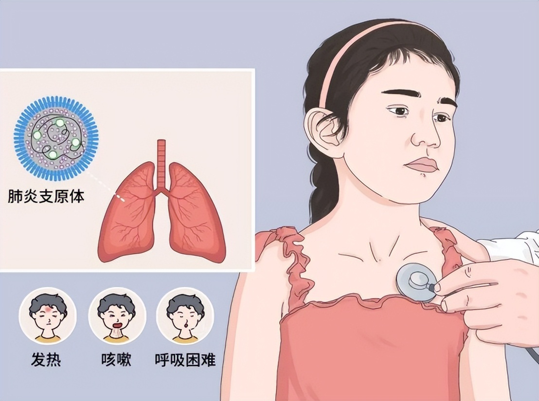 小儿肺炎严重的后果,严重的小儿肺炎怎么治疗