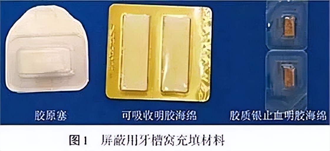 拔牙后牙窝里的海绵什么时候取出,一块海绵