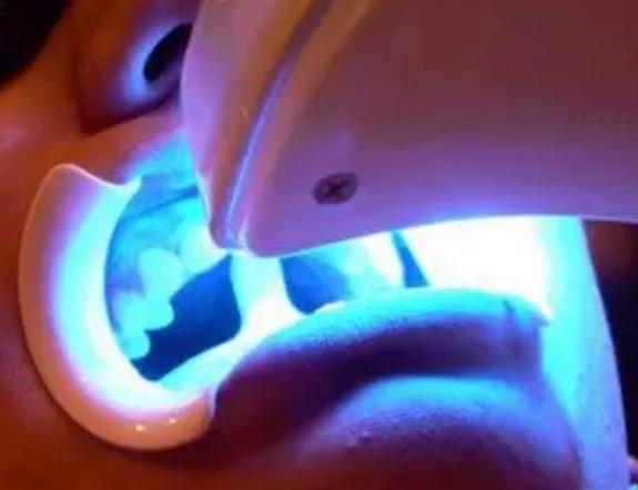 牙齿黄怎么变白去口臭,有牙黄口臭教你轻松解决