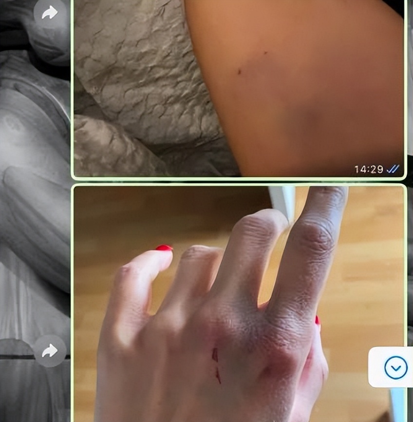 令人发指!29岁德国国脚被前女友指控多起家暴,脚踢孕妇腹部