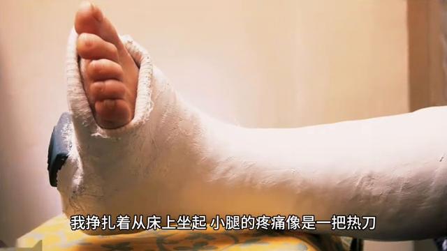 小腿骨折的症状,小腿骨折患者交流论坛