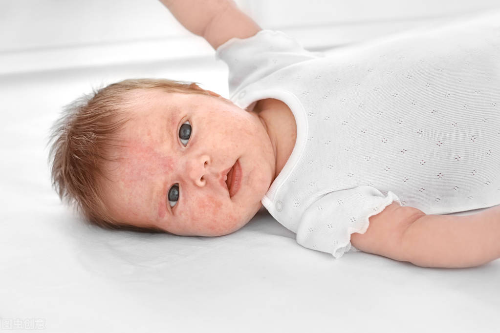 宝宝乳糖不耐受妈妈该怎么注意,宝宝乳糖不耐受应该怎么调理饮食