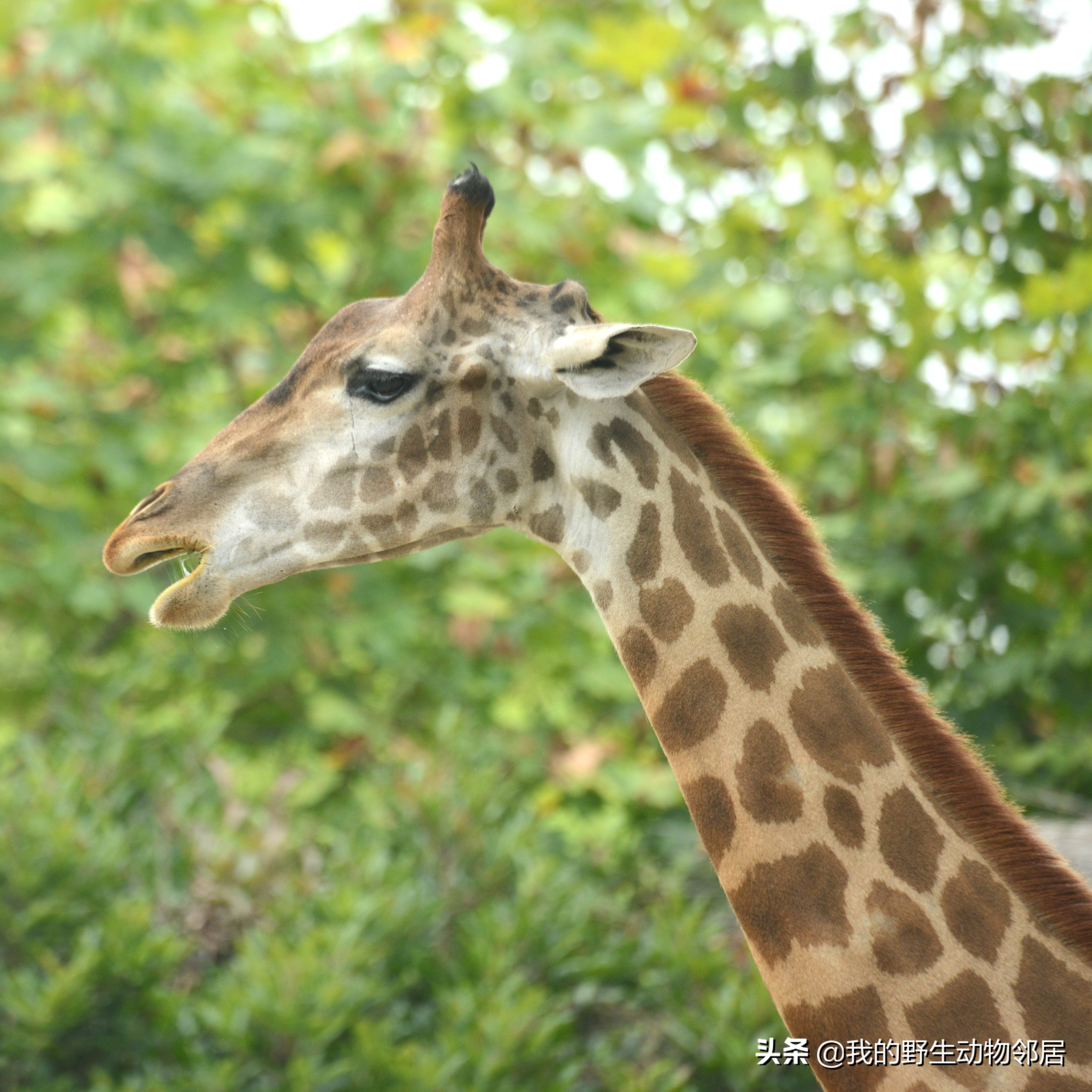 脖子长头发是怎么回事,脖子长淋巴结怎么办