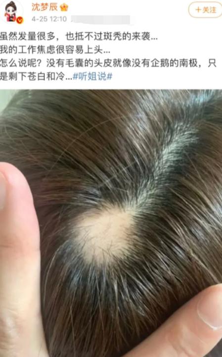 女明星也秃头？杨紫鞠婧祎全靠小心机，杨幂没刘海就是“光明顶”