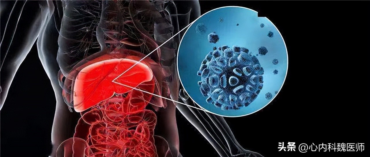 45岁男子吃3年恩替卡韦，却肝硬化了！医生：乙肝患者要注意3件事