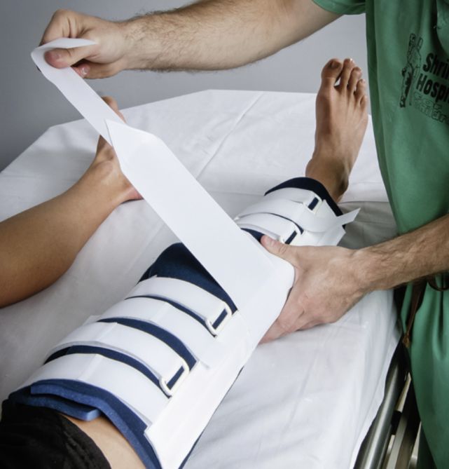 第一掌骨基底部骨折手法复位,骨折手法复位原理