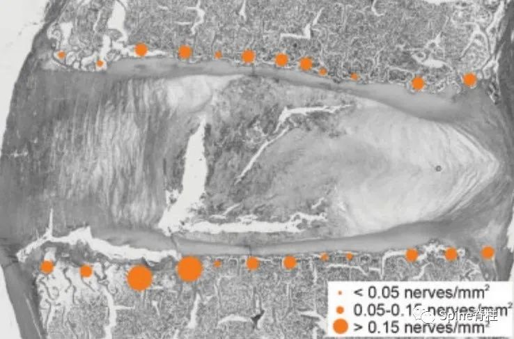 因腰椎问题导致的腰痛,慢性腰骶部疼痛