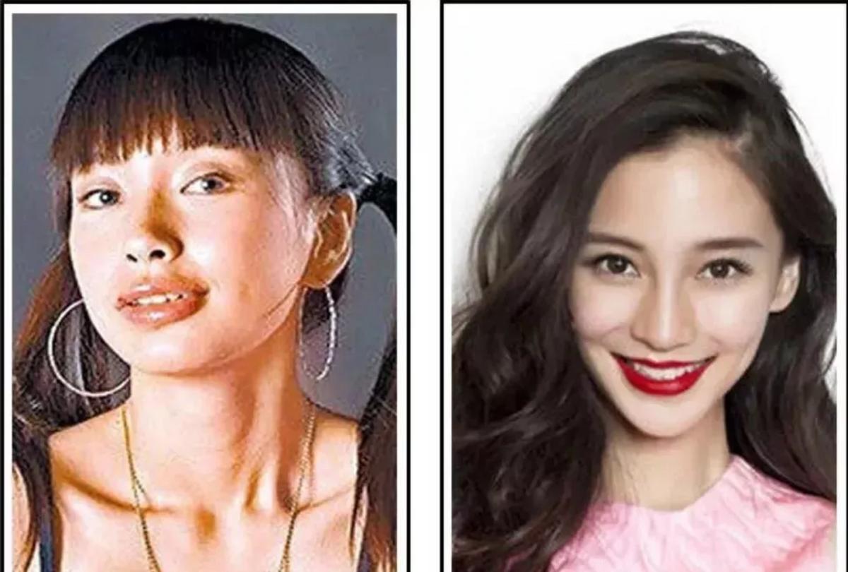 杨颖凸嘴分析,显老显凶嘴凸