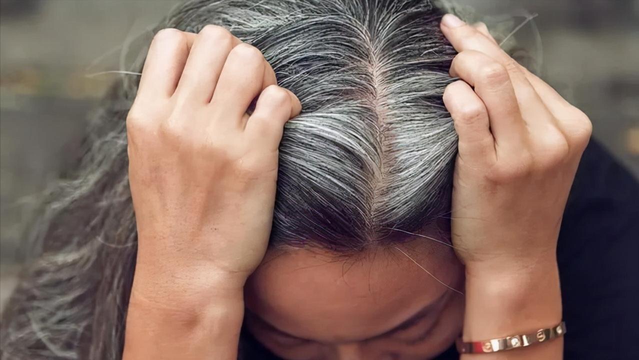 女性白发莫名增多？不要总认为是老了，或是体内缺乏这3种元素