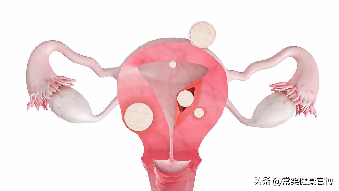 腹痛出血先兆流产,停经腹痛没流血是宫外孕吗