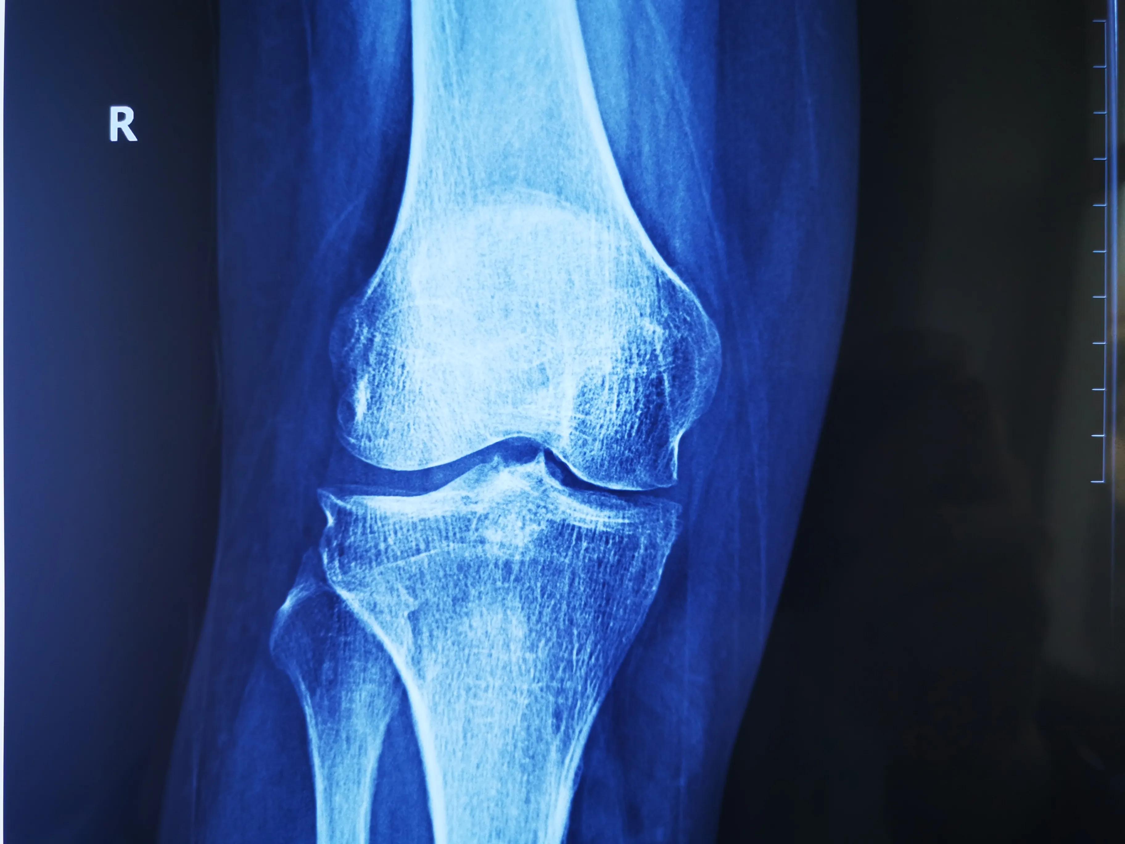 50岁膝盖怎样保养和锻炼,有效的保养膝关节的方法