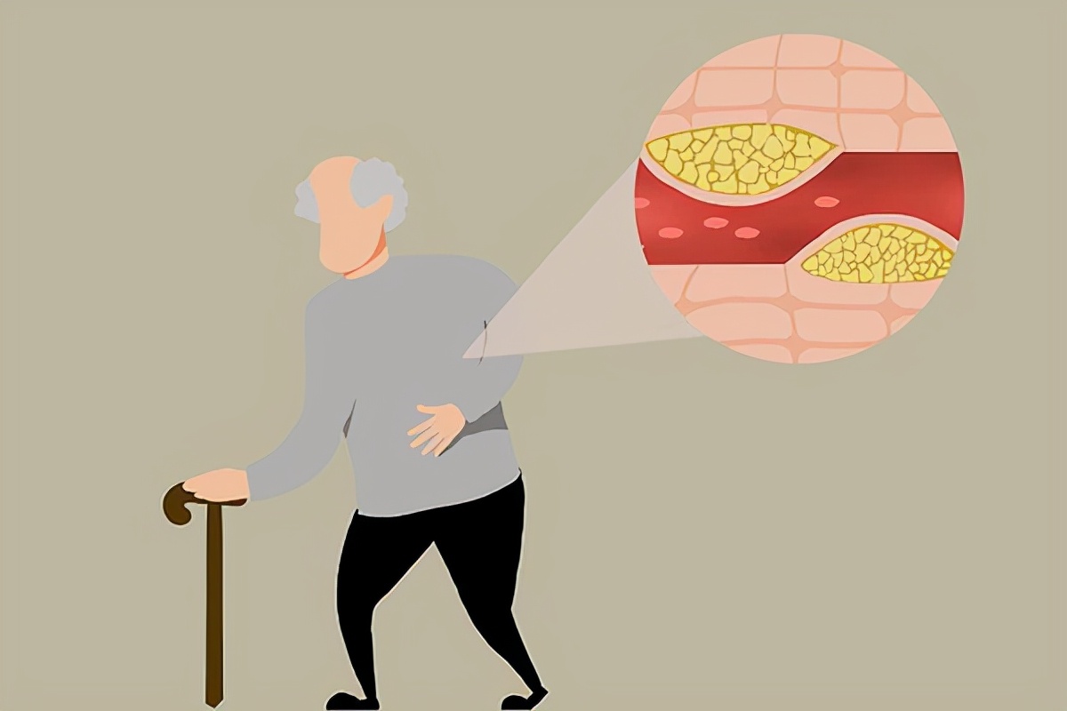 三七粉的功效可以通血管吗,常喝三七粉对血管有伤害吗