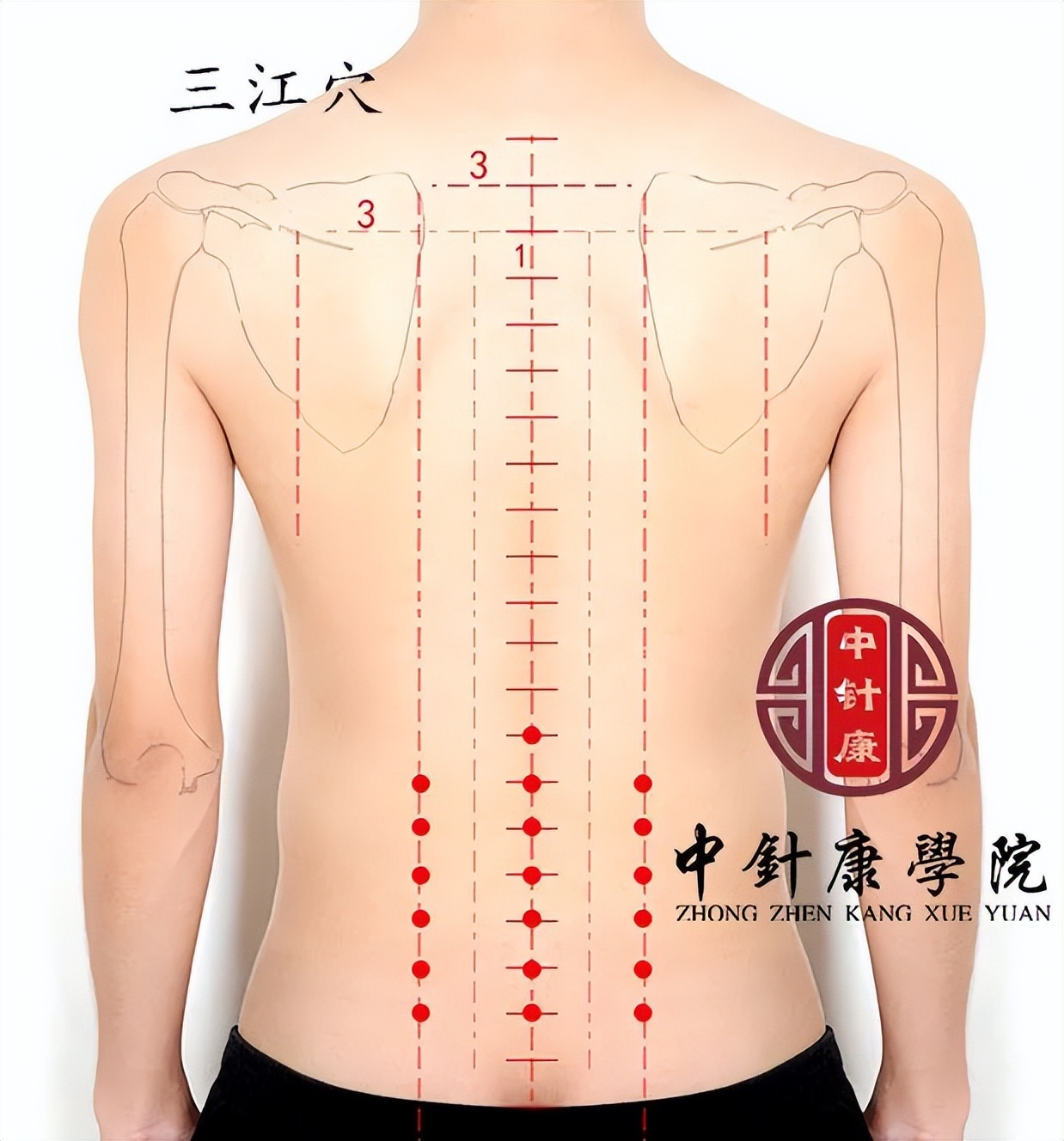董氏二针疗法,董氏奇穴三阴二阳常用穴位