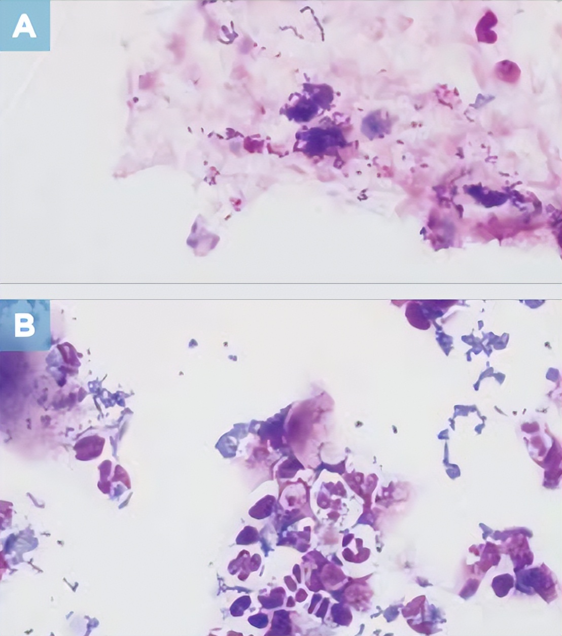 尿液干化学分析的实验原理,尿液标本采集操作