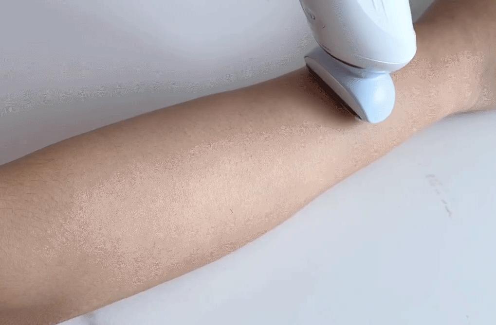 5款爆火脱毛产品真人实测!最便宜的居然是最好用?