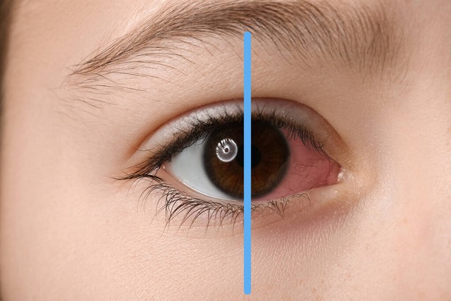 眼睛是心灵的窗户幽默回复,眼睛是心灵的窗户保护眼睛文案