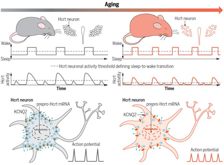 脑科学日报记忆缺陷,脑科学解释为什么人会感觉虚无