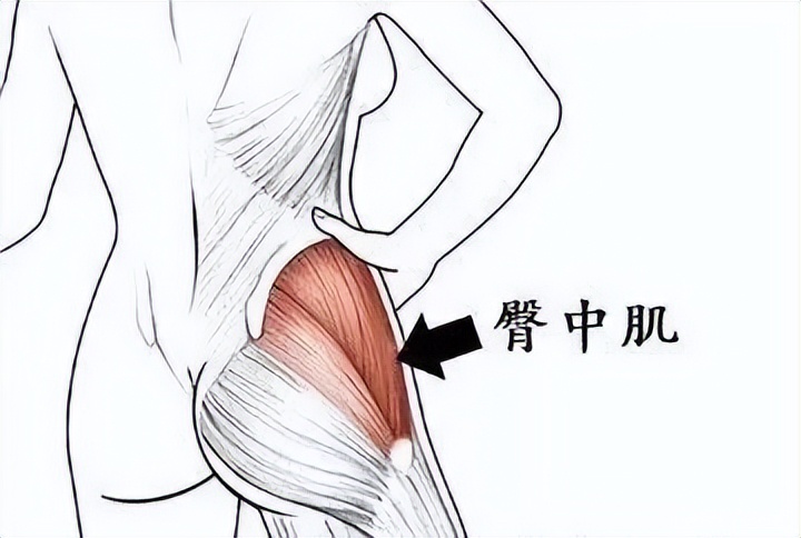 走路像鸭子臀中肌问题,走路左右摇摆像鸭子一样