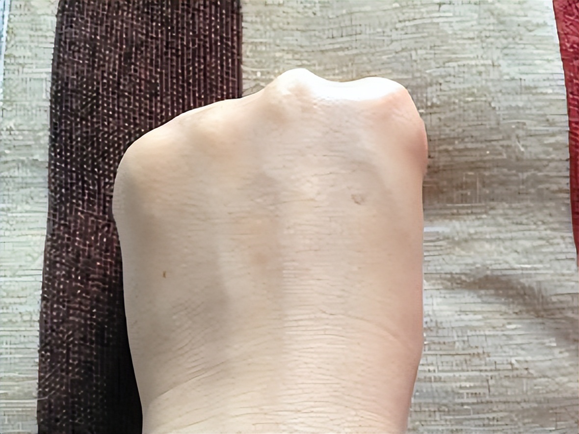 皮肤干吃什么补水效果最好,排毒养肝的中成药有哪些