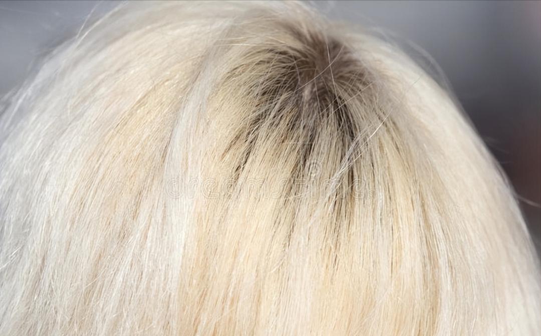 脱发染发对头发危害大吗,染发的危害脱发概率