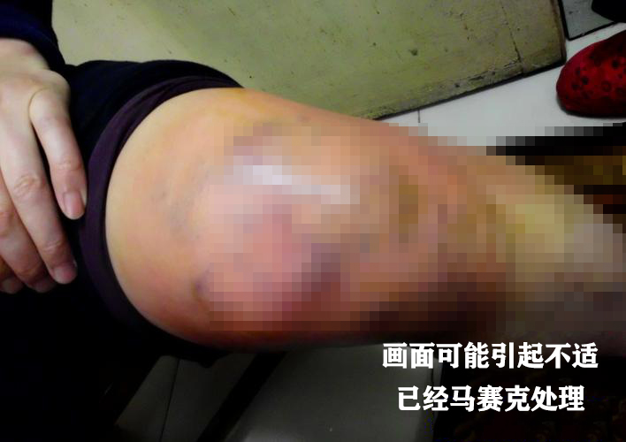 膝盖不痛、顽疾可祛，让腿轻松，今天主讲如何解膝痛腿痛