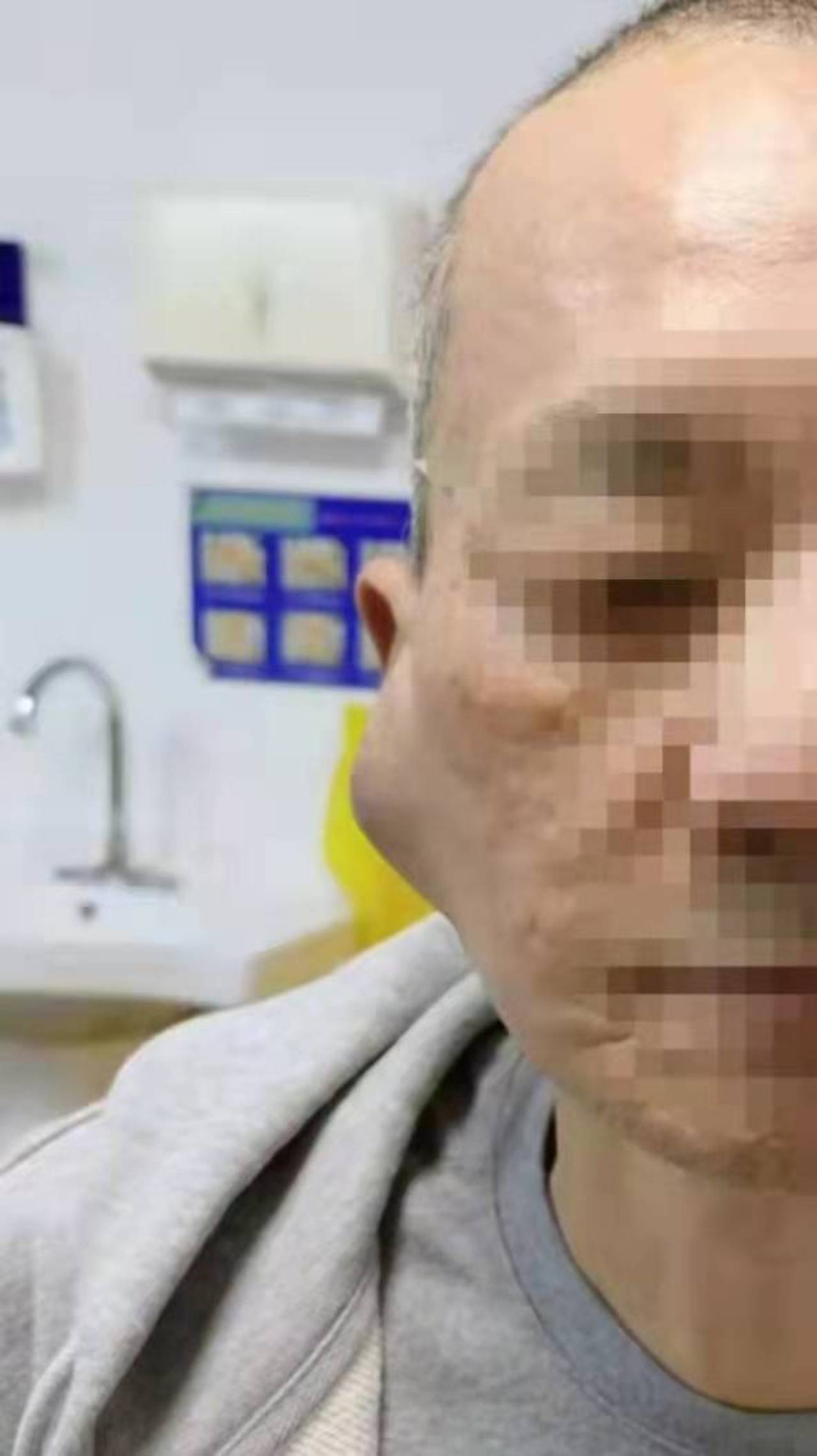 蚕豆变色了还能吃吗,蚕豆表面变褐色