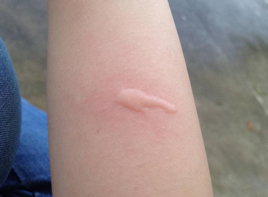 家里有灭蚊子最有效的方法,教你一招轻松解决蚊子