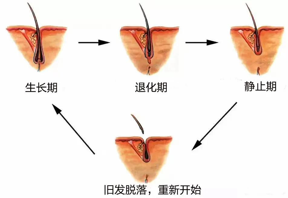 年轻女性突然白发增多是什么原因,中年女性有白发怎么调理