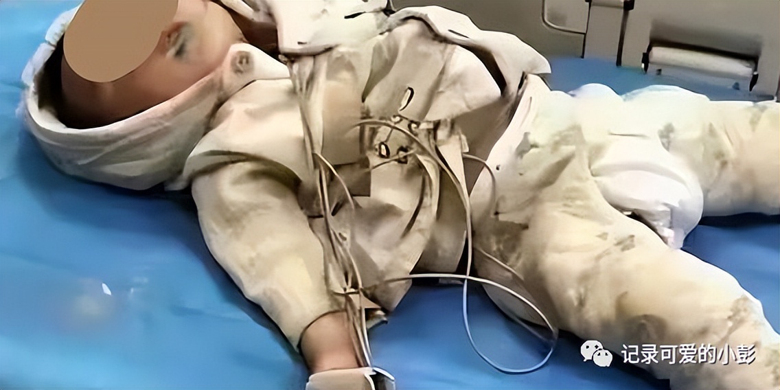 一岁宝宝喝奶时突然流了一点鼻血,一岁宝宝喝奶后鼻涕流不止