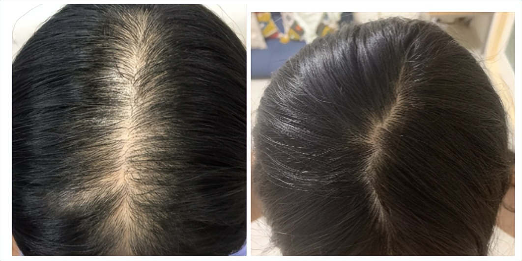 孕妇洗发水安全性测评,孕妇洗发水孕妇专用安全吗