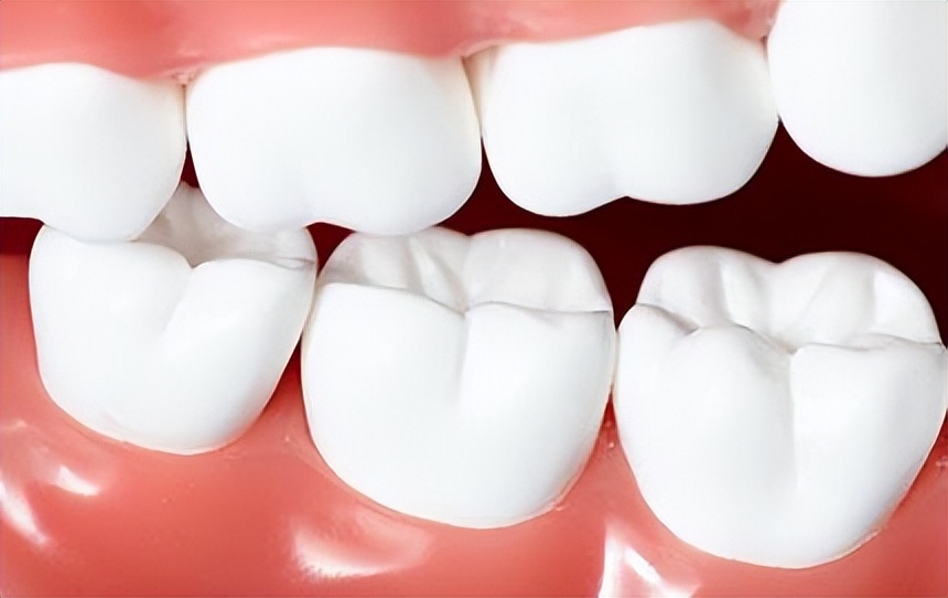 老年人牙齿松动最佳补救方法,撞击牙齿松动最佳补救方法