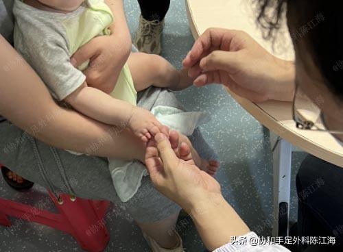 宝宝36周出生要紧吗,宝宝出生37天脐带没有脱落