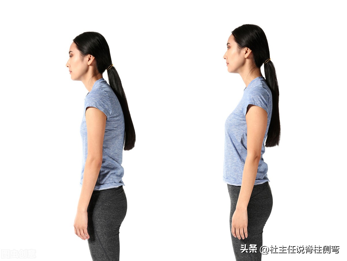 体态矫正含胸驼背学什么舞蹈好,体态矫正含胸驼背外国