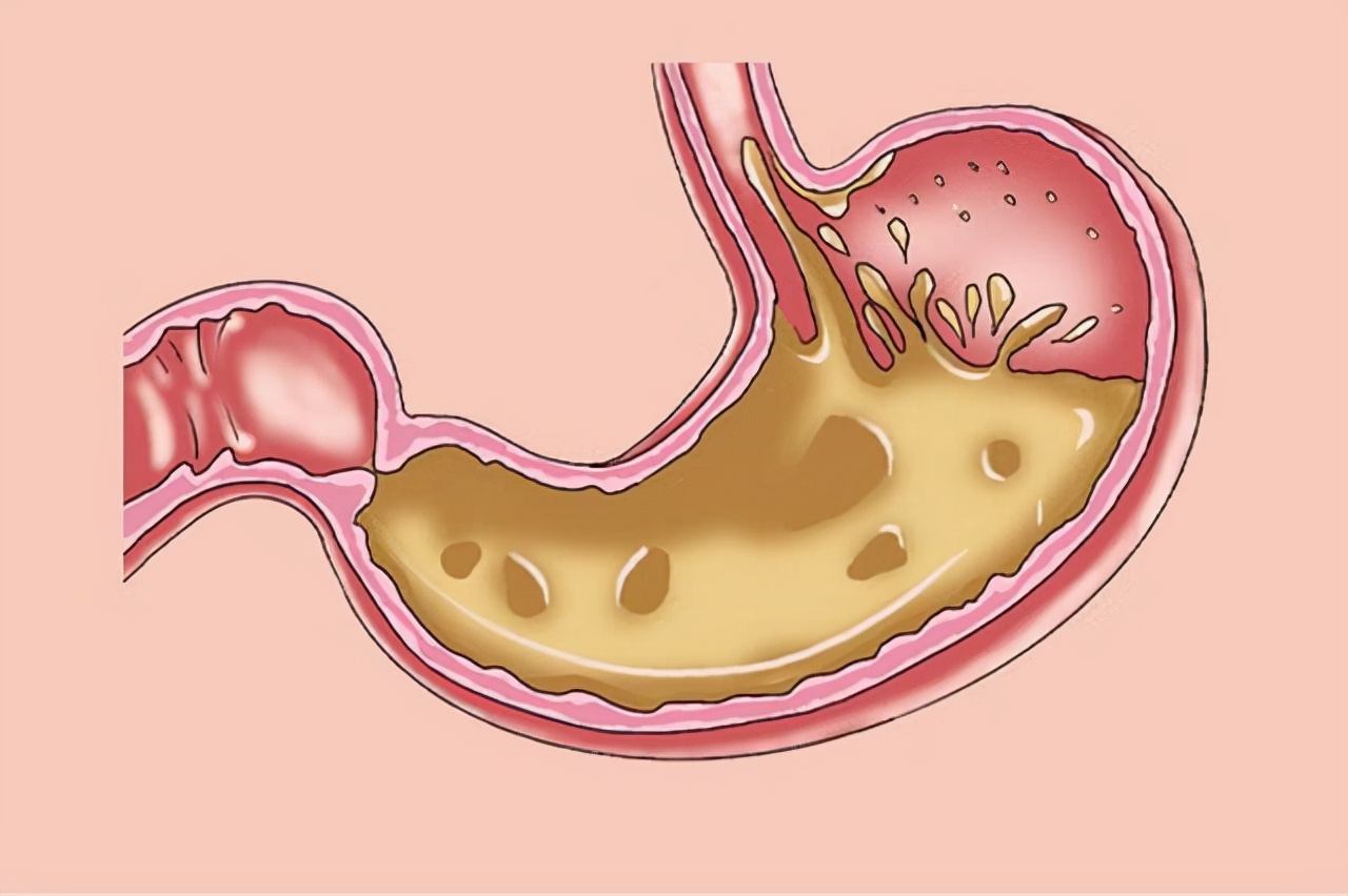 高血压吃维生素b2的作用与功效,糖尿病高血压可以吃维生素b2吗