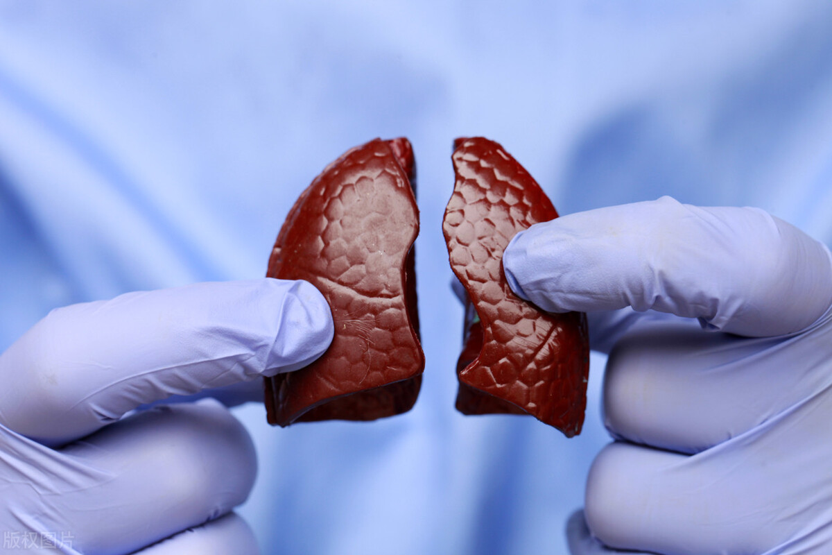 肺结节乳腺结节，祸根就是“痰”，医圣张仲景有妙法，化痰散结节