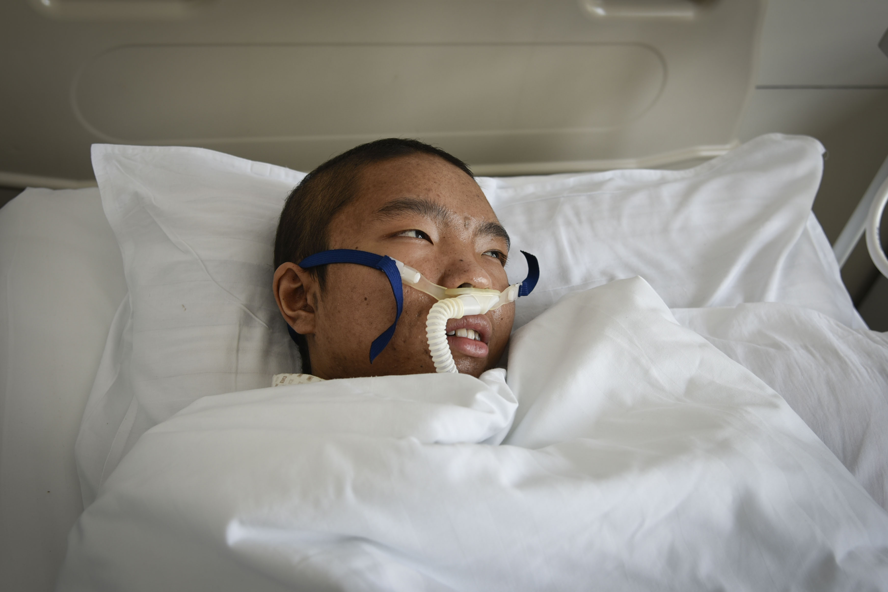 12岁男孩突然消瘦是什么原因,十六岁男孩急剧消瘦