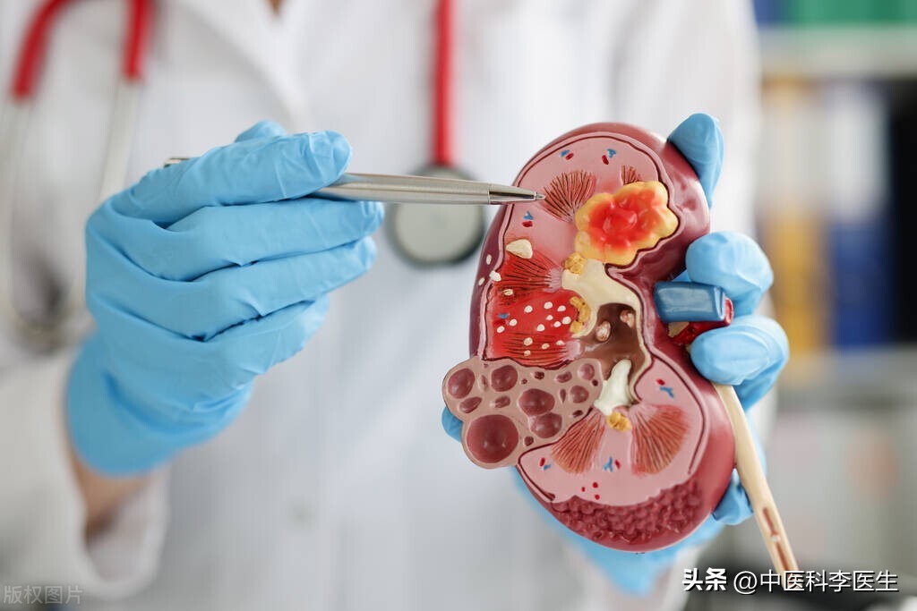 尿毒症跟长期不良习惯有关吗,为什么尿毒症到现在都攻克不了