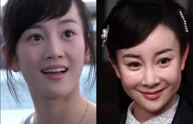 整容毁掉的四位女星,盘点整容失败惨不忍睹的十大女星