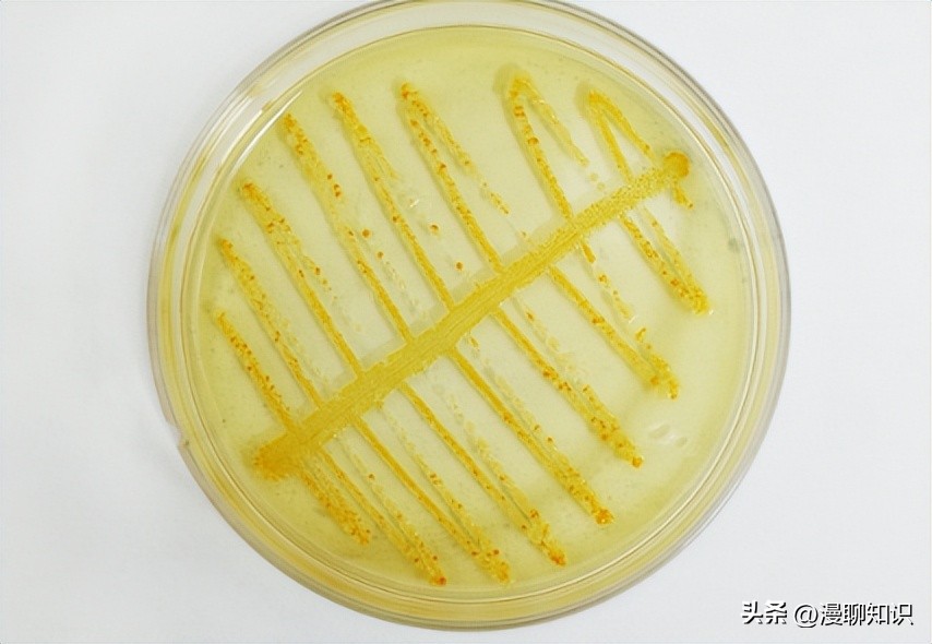大肠杆菌的结构名称,大肠杆菌菌株基因型