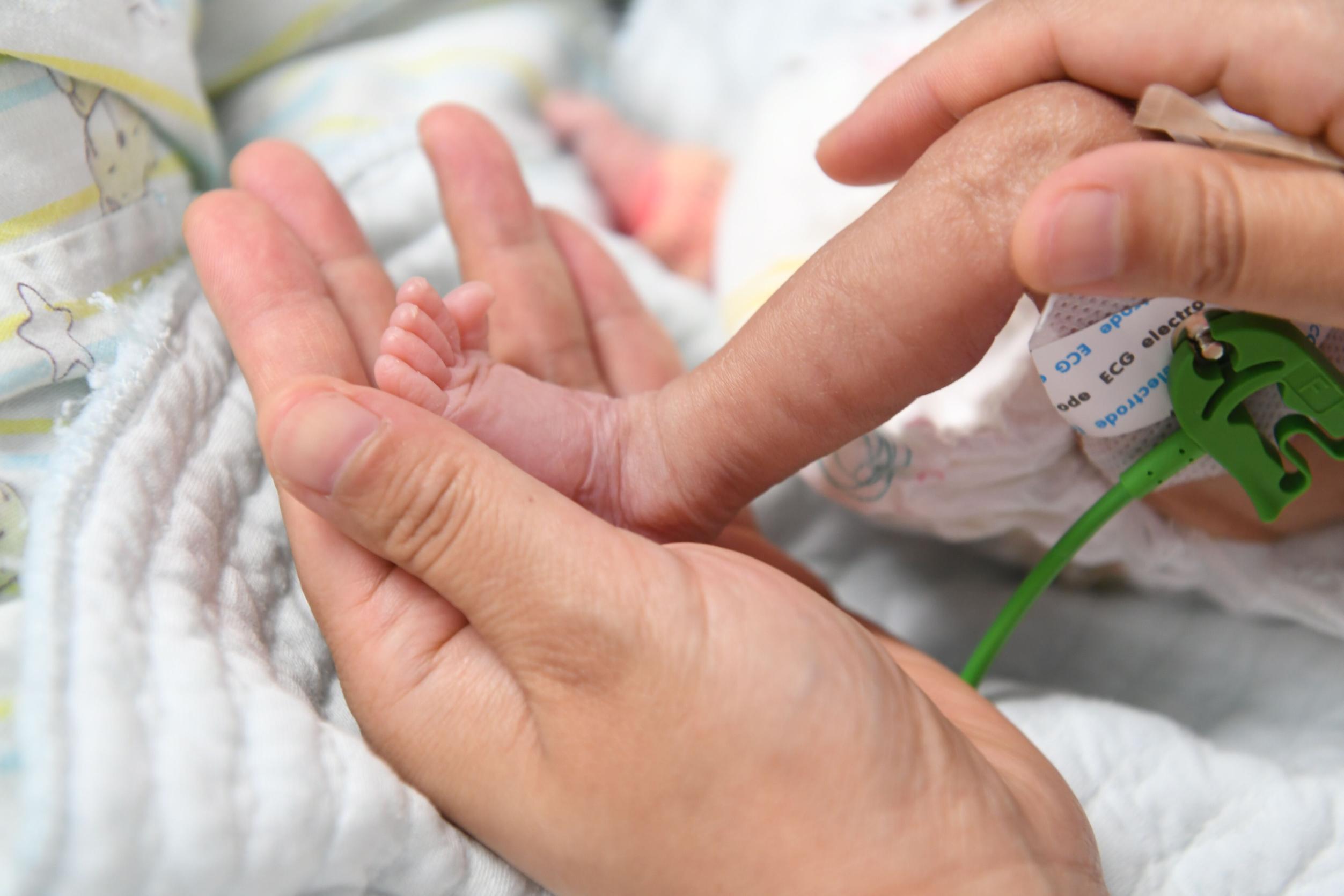 婴儿先天性心脏病怎么护理,婴儿先天性心脏病做什么手术好