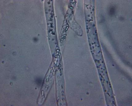 水产养殖霉菌怎么处理,水产养殖杀水霉方法