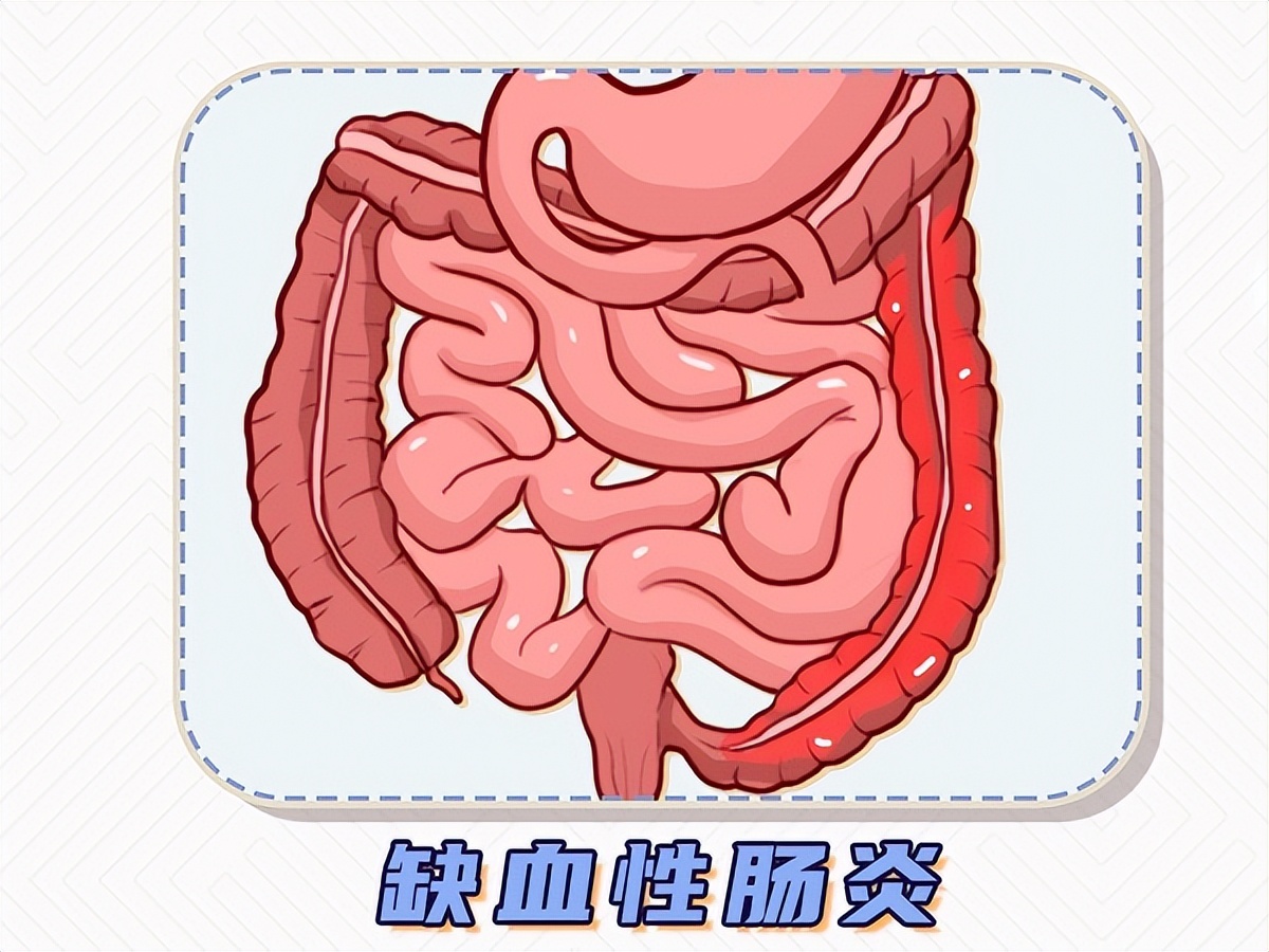 月子里孩子便血什么原因,儿童便血是什么原因造成的