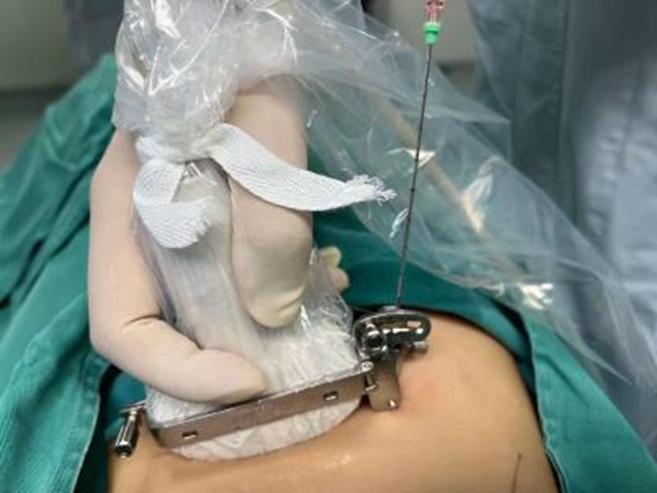 直肠癌转移的方式,直肠癌转移盆腔化疗方案