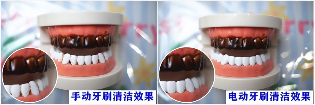 儿童电动牙刷推荐排行榜飞利浦,欧乐b和usmile儿童电动牙刷哪个好