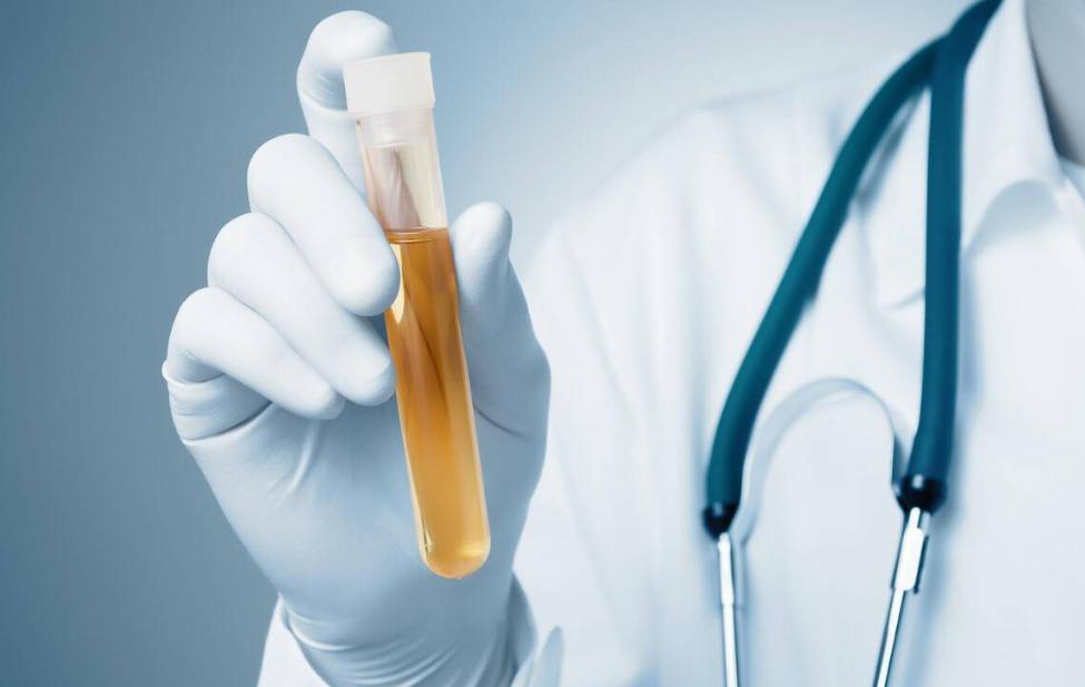 尿酸偏高在睡觉时会发生什么,尿酸高晚上睡觉有四种表现