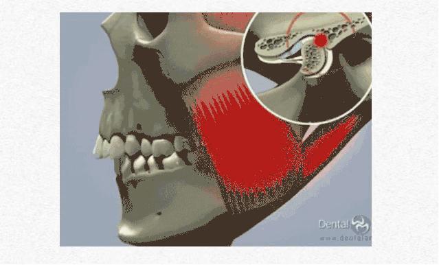 张嘴呼吸怎么自然改善,睡觉张嘴呼吸会变丑的图片