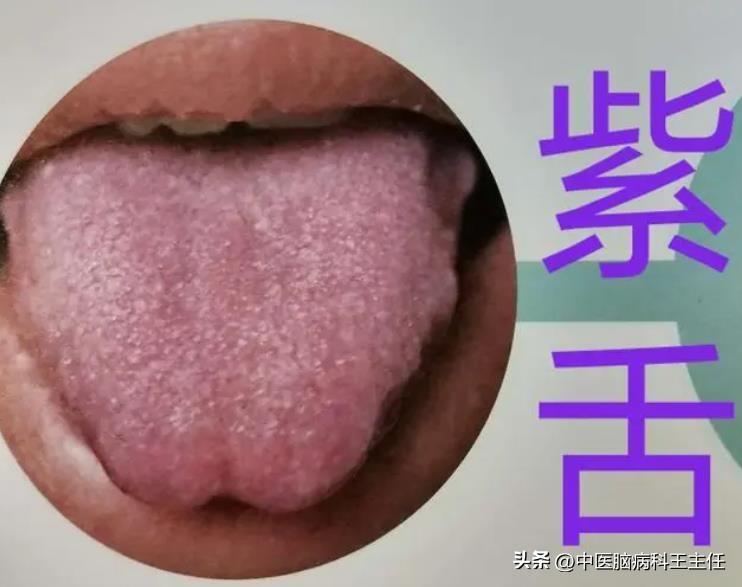 总是焦虑怎么调整,严重焦虑抑郁怎么拯救自己