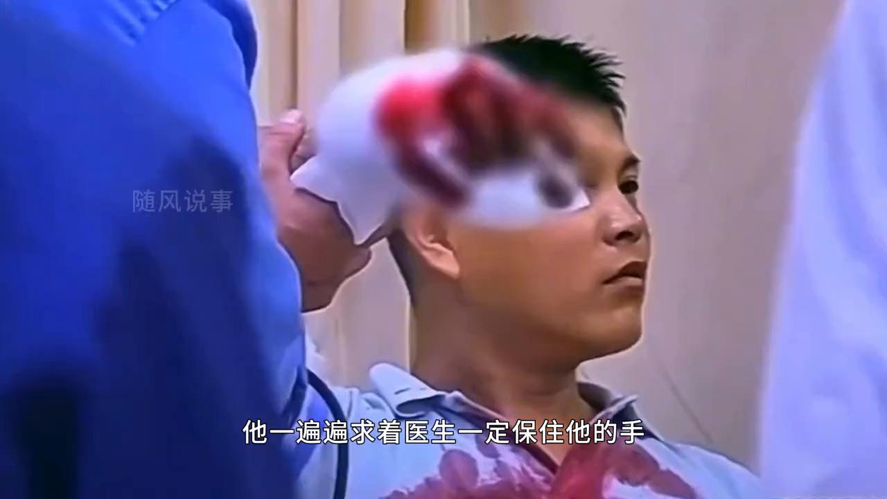 男子手指被压断淡定走路去医院,手掌被压了一个小时