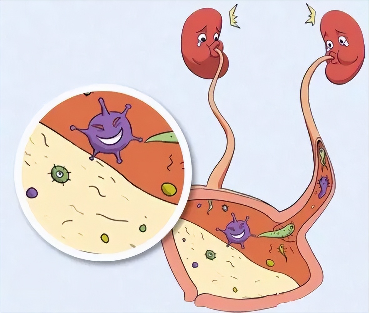 女性身体构造很特殊，憋尿的危害更大！